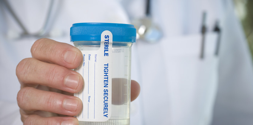 When Does Drug Testing Violate the California Labor Law?